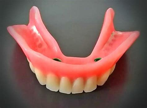 Locator Implant Supported Dentures Procare Denture Clinic And Implant