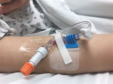 Optimal Dressing Securement Of Peripheral Iv Catheters Not Yet Found