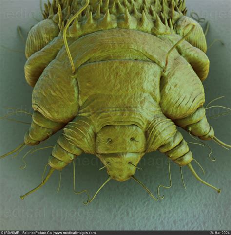 Stock Image A Close Up View Of The Cause Of Scabies The Mite