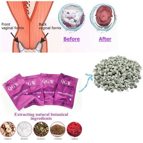 20pcs Natural Herbal Womb Vagina Cleansing Healing Tightening Detox