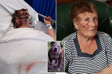 Woman Mauled By Pit Bull Like A Lion Dragging An Antelope In 30