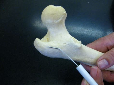 Boned: Human Skeleton - femur