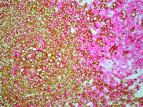 Polink-DS (Double Staining) IHC Detection System