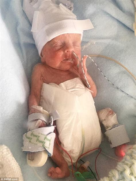 Meet The Miracle Baby Boy Born At 22 Weeks Daily Mail Online