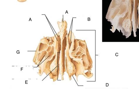 Ethmoid Bone Markings Diagram Quizlet