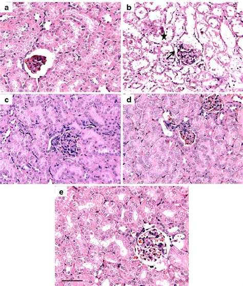 Histological Alterations In Kidney Of Mice Photomicrographs Of Kidney