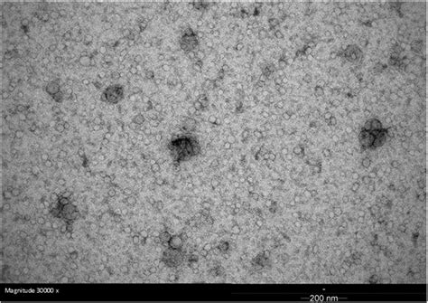 Electron Microscope Image Of The Extracted Serum Vesicles Typical Size
