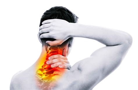 What Is Occipital Neuralgia Occipital Neuralgia Causes Symptoms And