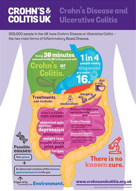 10 Things You Need To Know About Ulcerative Colitis Crohns And Colitis Uk