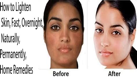 How To Lighten Skin Fast Overnight Naturally Permanently Youtube