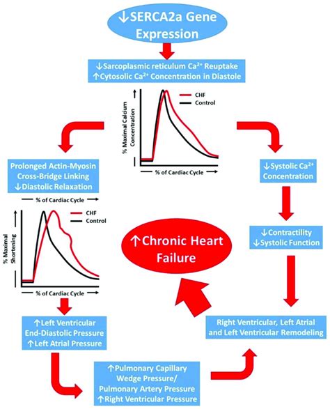 Schematic Representation Of The Progression Of Chronic Heart Failure