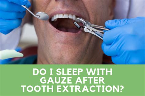 How Long To Keep Using Gauze In After Tooth Extraction After Wisdom