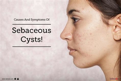 causes and symptoms of sebaceous cysts by dr harish lybrate