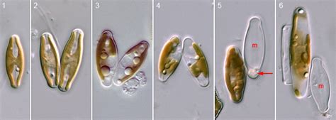 Algae World Sellaphora Sexual Reproduction Introduction