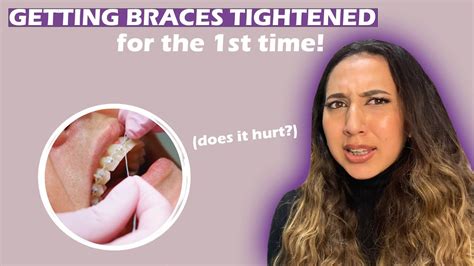 Getting My Braces Tightened For The First Time 1 Month Update Youtube