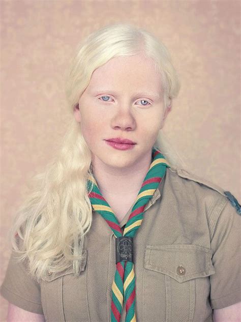 Gustavo Lacerda Photography 7 Albino Girl Albinism Albino Model