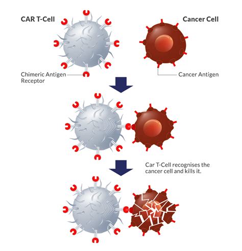 Car T Cell Therapy Singapore