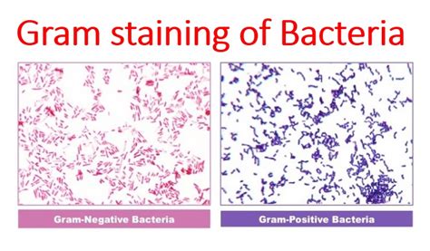 Gram Staining ~ Microbiology Notes
