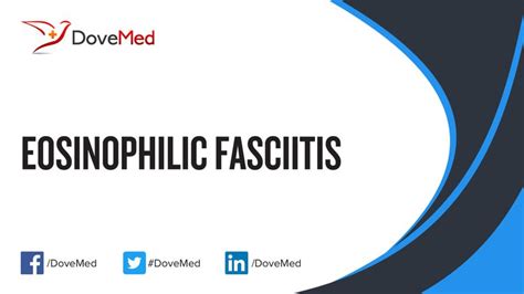 Eosinophilic Fasciitis