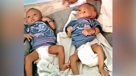 Ethiopias Tigray Conflict My Wife Died Giving Birth To Twins While