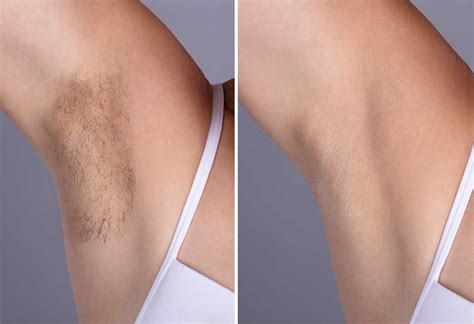 Depending on how much hair you have, it might take two or three wax applications per armpit to get the job done. how to remove underarm hair easy tricks and home remedies
