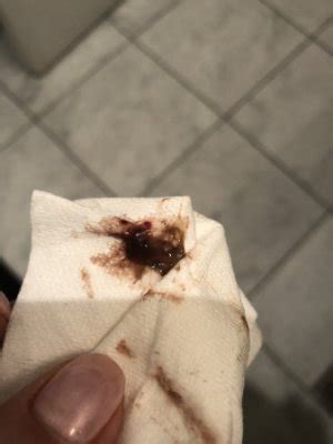 Mild brown discharge can happen in the first few weeks of pregnancy. Brown blood clot...warning graphic pic! - September 2018 ...