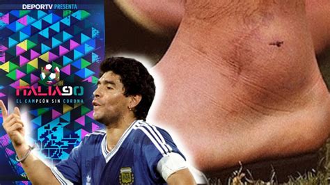 Doloroso La Verdadera Historia Del Tobillo De Diego Maradona En El Mundial De Italia 90 Youtube