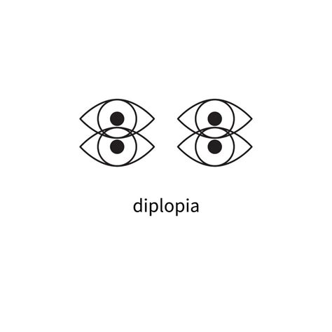 Double Vision In One Eye Monocular Diplopia