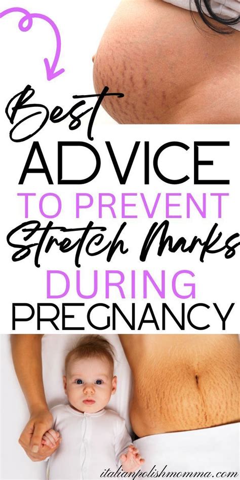 How To Prevent Stretch Marks During Pregnancy Artofit