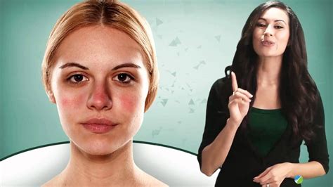 Blotchy Skin Prevention And Treatments You Need To Know Blotchy Skin