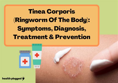 Tinea Corporis Ringworm Of The Body Signs Treatments And Prevention