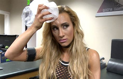 Carmella Gets A Black Eye From Nikki Bella S Attack Photo Sasha Banks And Charlotte Flair S