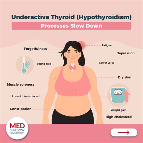 Thyroid Problems Symptoms Treatments And Side Effects Medshadow