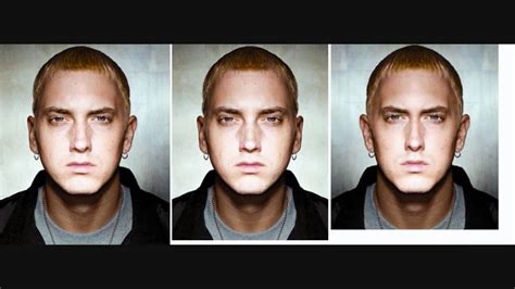 Eminem Facial Surgery Telegraph