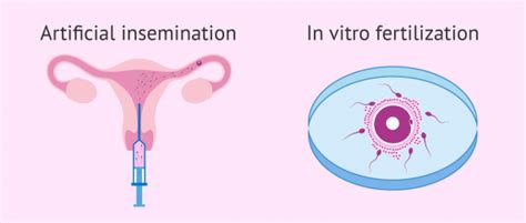 Main Assisted Reproduction Methods