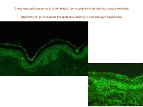 Immunofluorescence In Dermatopathology Antibody Structure