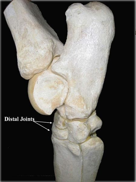 Chronic Hock Pain Laser Arthrodesis Surgical Fusion May Be The