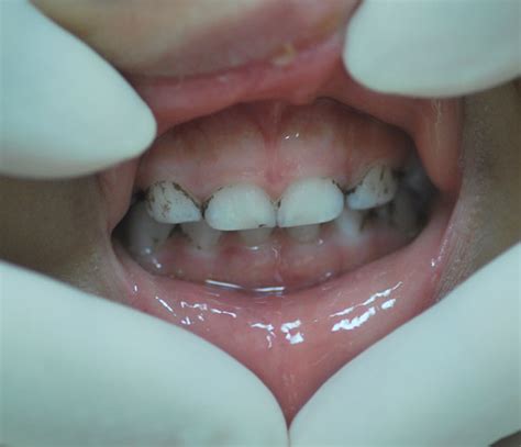 The Oral Care Centre Singapore Dental Specialist Beyond Aesthetics