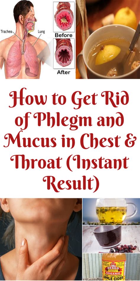 It won't treat your allergies at the root cause, but i understand that there are times when you just want to be able to go out in public without sneezing, sniffling or coughing. How to Get Rid of Phlegm and Mucus in Chest & Throat ...