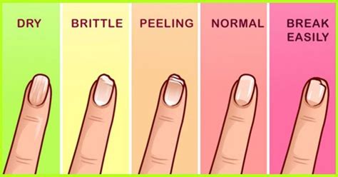 Strengthening Your Nails 101 Everything You Need To Know Flawlessend