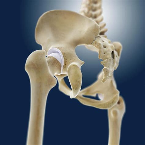 Hip Anatomy Photograph By Springer Medizinscience Photo Library Fine