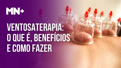 Benefícios E Como Fazer O Tratamento De Ventosaterapia