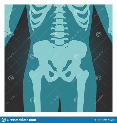 X Ray Shot Of Pelvis And Spinal Column Human Body Bones Radiography