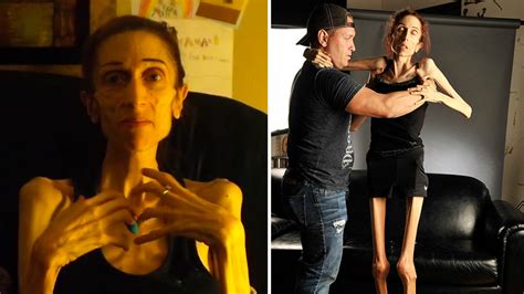 video california actress rachael farrokh who described descent into anorexia in a viral video