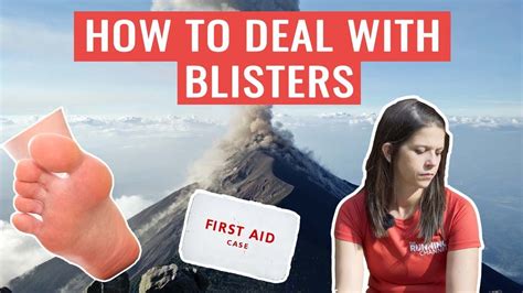 Should You Pop A Blister How To Deal With Blisters The Running Channel