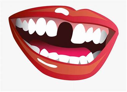 Teeth Missing Smile Funny Clipart Tooth Dentist