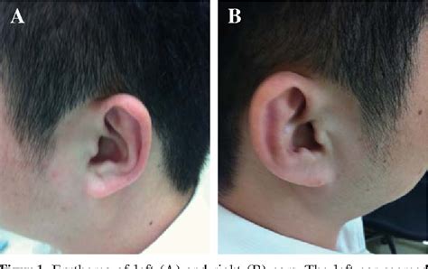 Figure 1 From Red Ear Syndrome Semantic Scholar