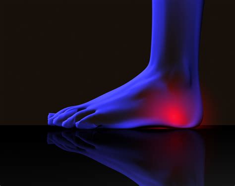 Five Heel Pain Causes Atlanta Podiatry American Foot And Leg Specialists