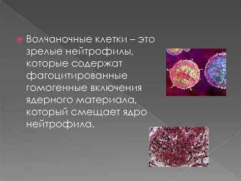 Диета при системная красная волчанка Системная красная волчанка! (СКВ) - презентация онлайн Системная красная волчанка! (СКВ) - презентация онлайн Диета при системная красная волчанка