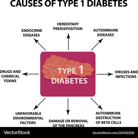 The Causes Of Diabetes Type 1 Infographics Vector Image